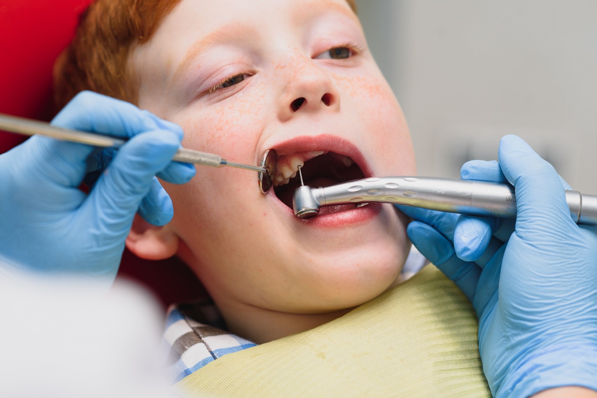 Do Dental Fillings Affect My Child's Dental Development? Information for Parents