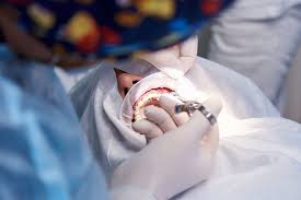 Dental Treatments Under General Anesthesia
