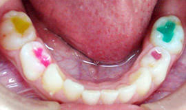 images (9)