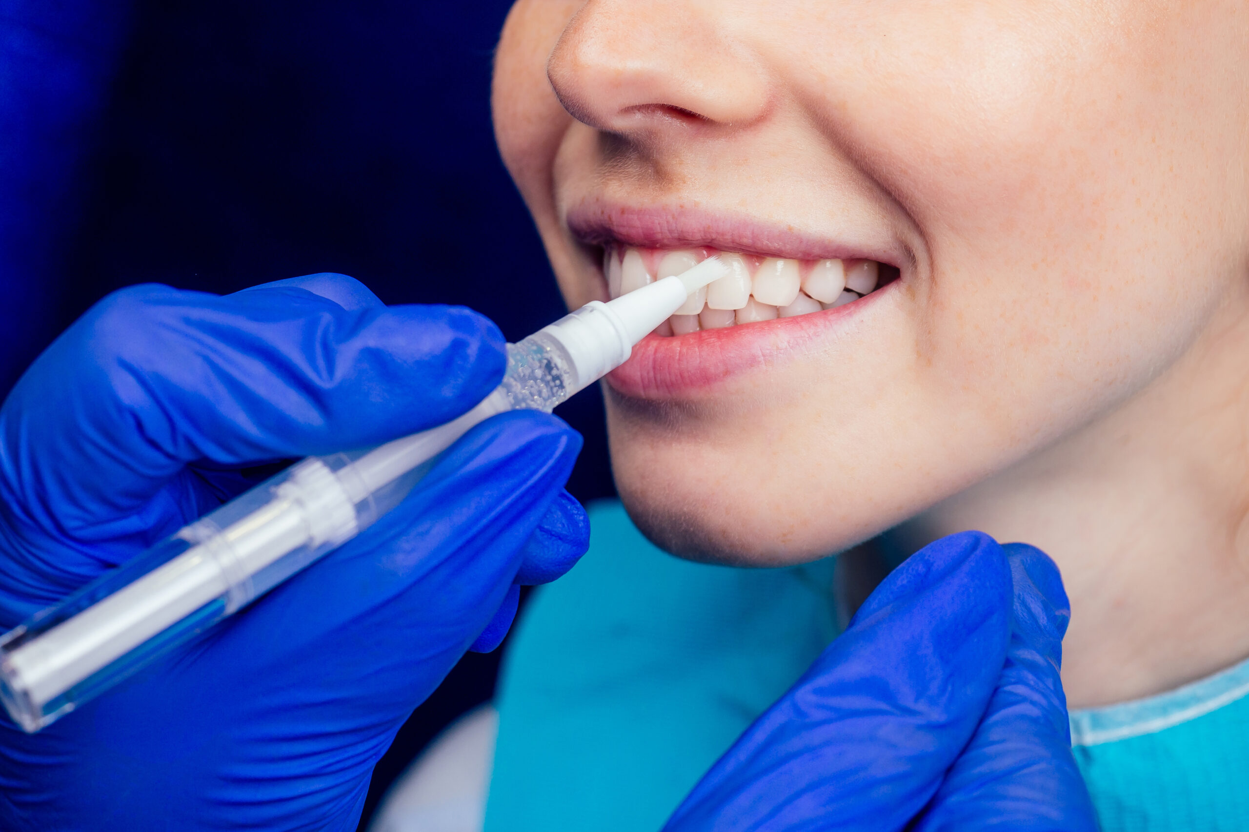 dentist works on tooth crown in dental laboratory ultraviolet painting teeth with mineral and calcium cream to young red haired ginger woman